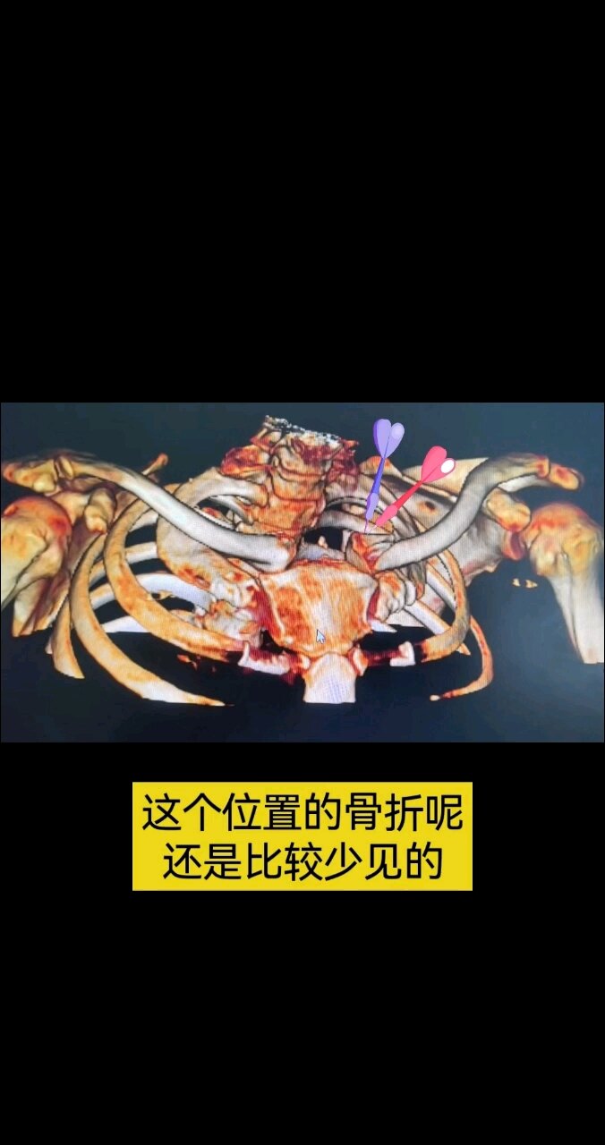 默认图片