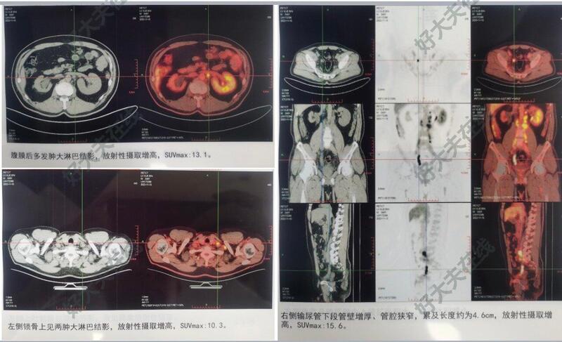 圖文圖片