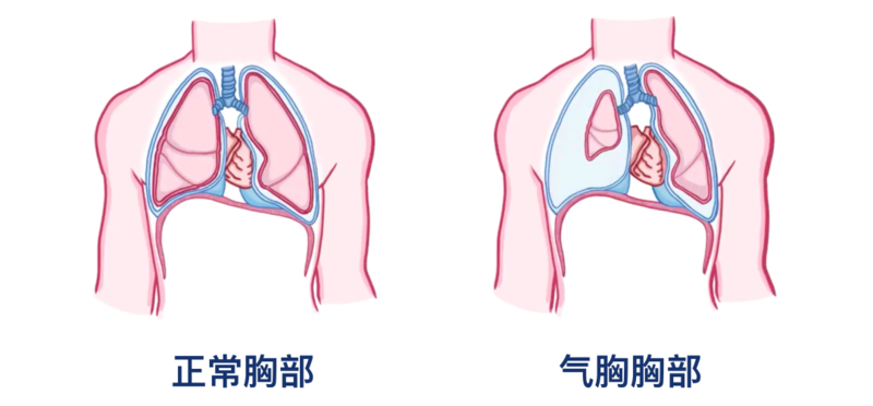 圖文圖片