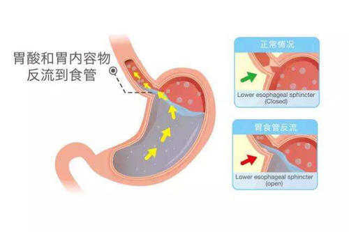 暂无