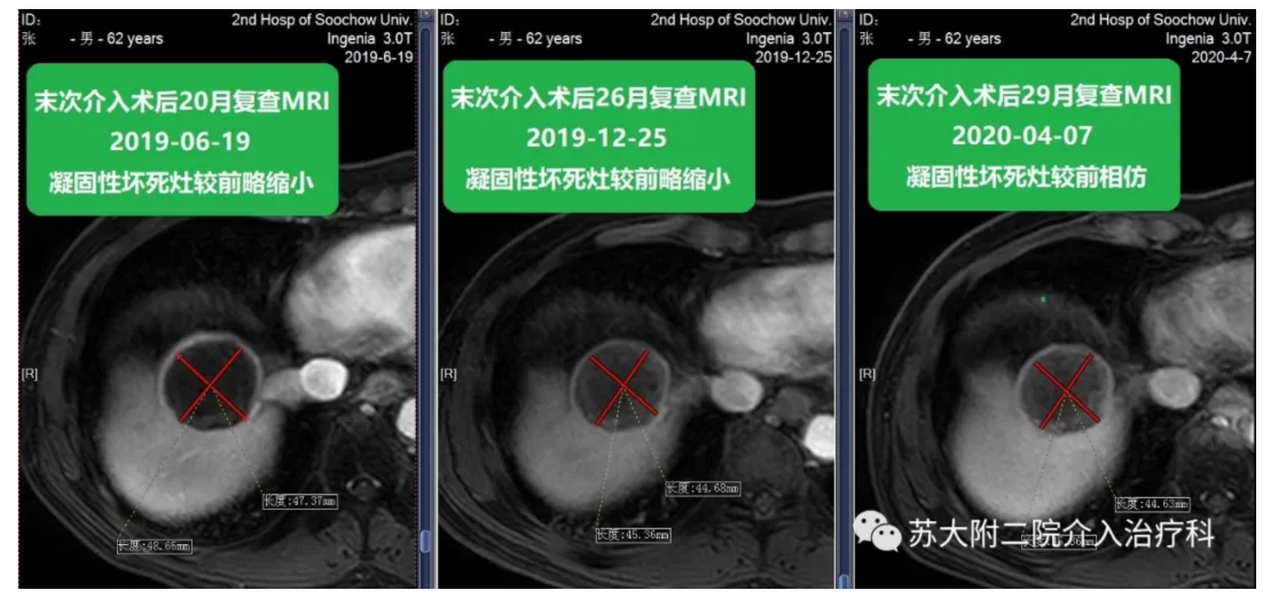 1595412193642990.png image.png