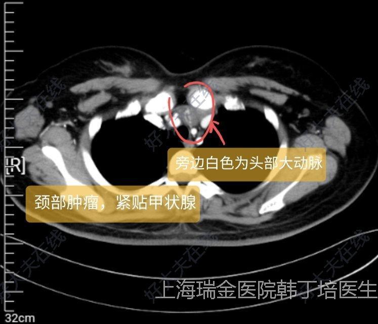 圖文圖片