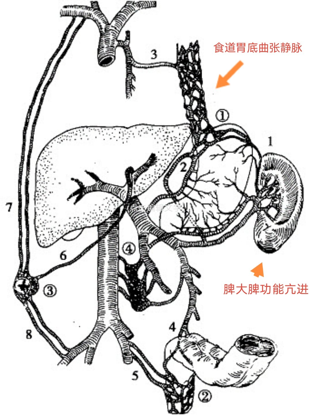 门脉高压性肠病图片