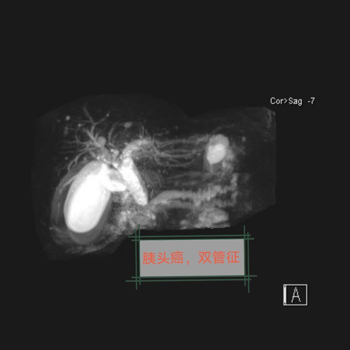 MRCP_edit_372186412780708.jpg