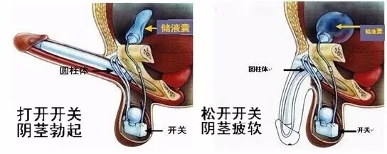 阳痿和早泄是一回事吗?