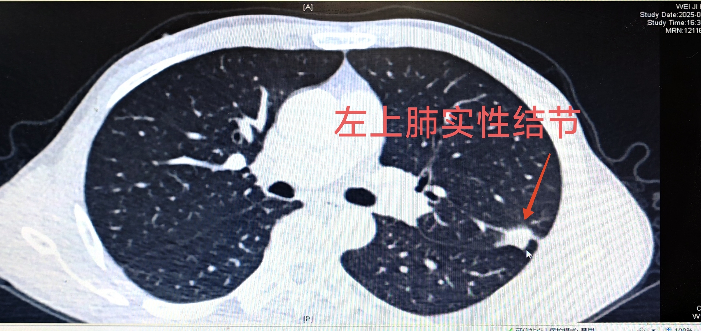 圖文圖片