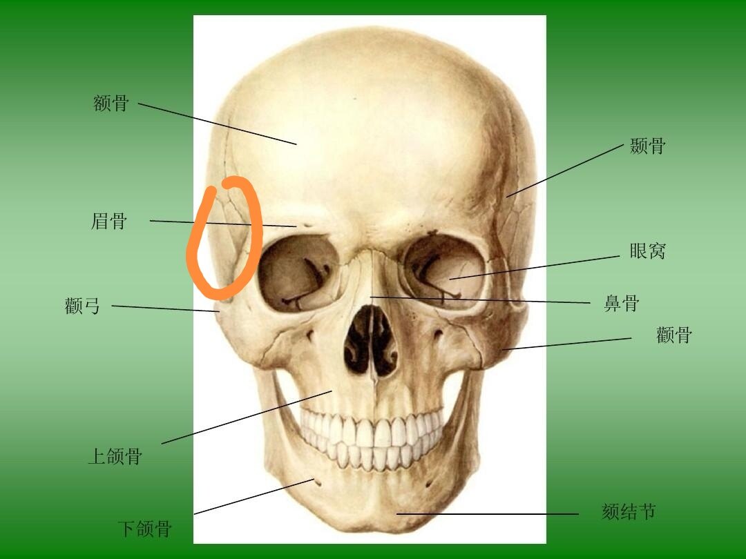 下上图中红色的位置就是颞肌,是颞窝(下下图圈内)里体积最大软组织,颞