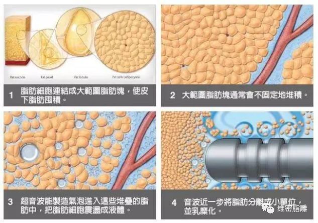 维密脂雕和黄金微雕图片