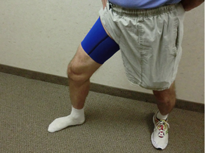 患者教育:肌肉拉伤(基础篇)_韧带损伤_韧带损伤相关疾病 - 好大夫在线