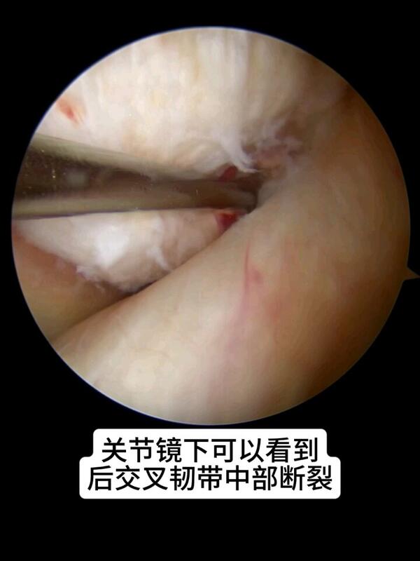 視頻封面