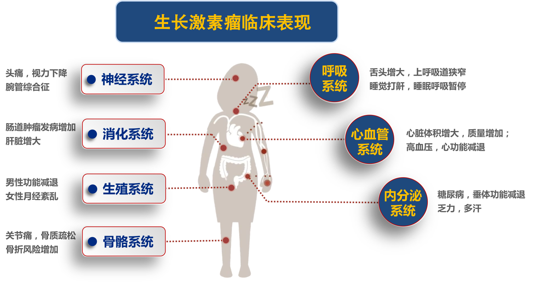 生长激素gh型垂体瘤诊疗简介