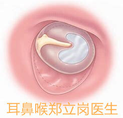 1626160872227238.jpg 1626160872227238.jpg