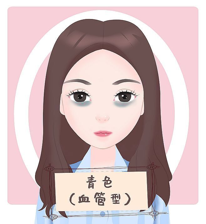为什么不熬夜仍然有黑眼圈 眼部整形 眼部整形 为什么不熬夜仍然有黑眼圈 眼部整形 眼部整形