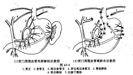 极快的手术 zoYBAFzf3siANUi8AAB51YvCNLw638.jpg?_ms_=58a5