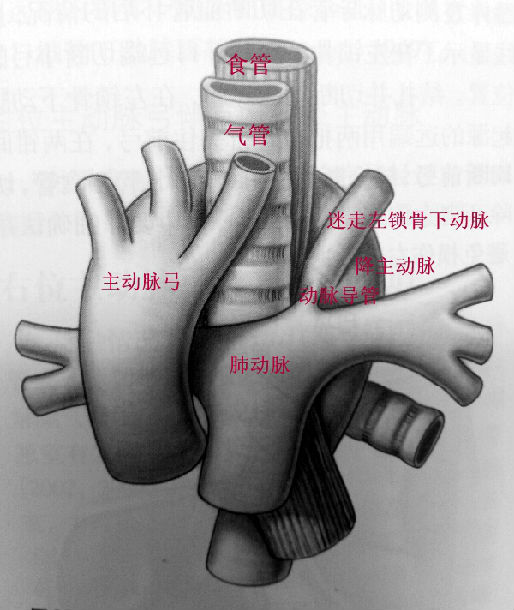 主动脉弓位置示意图图片