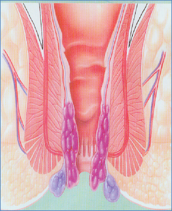 zoYBAFzn-SWAP_OTAActTRmMw9Q008.png?_ms_=020f