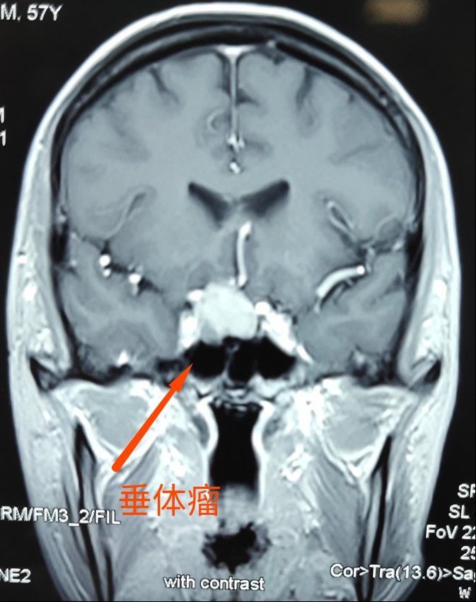 暂无