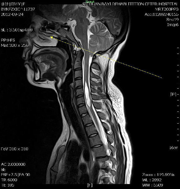 头颅MRA解剖图片