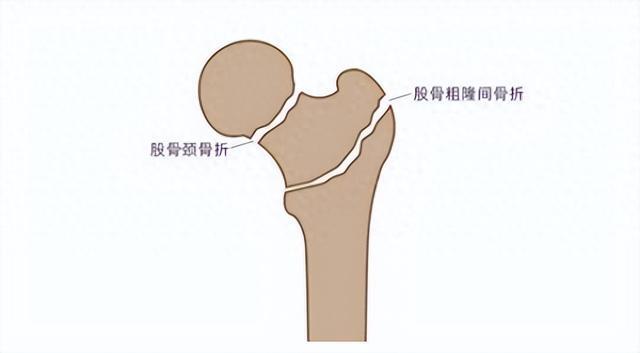 圖文圖片