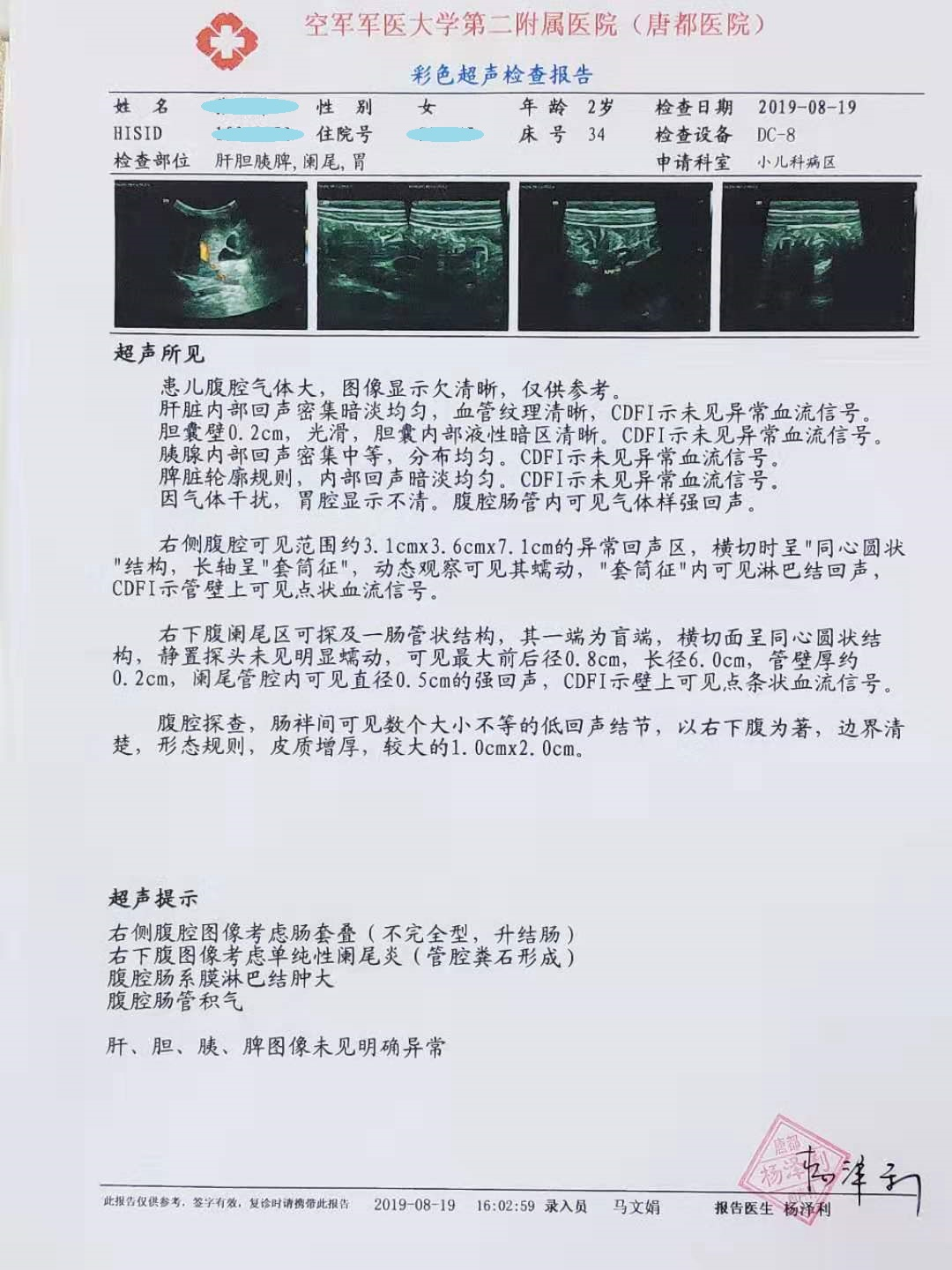肠套叠彩超报告图片图片