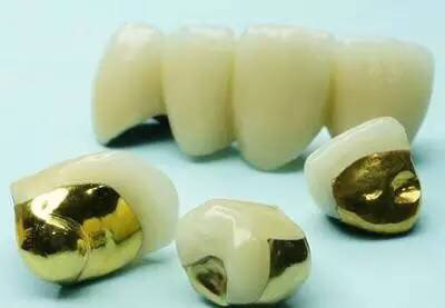 根管治疗后,别忘给牙齿戴上安全帽