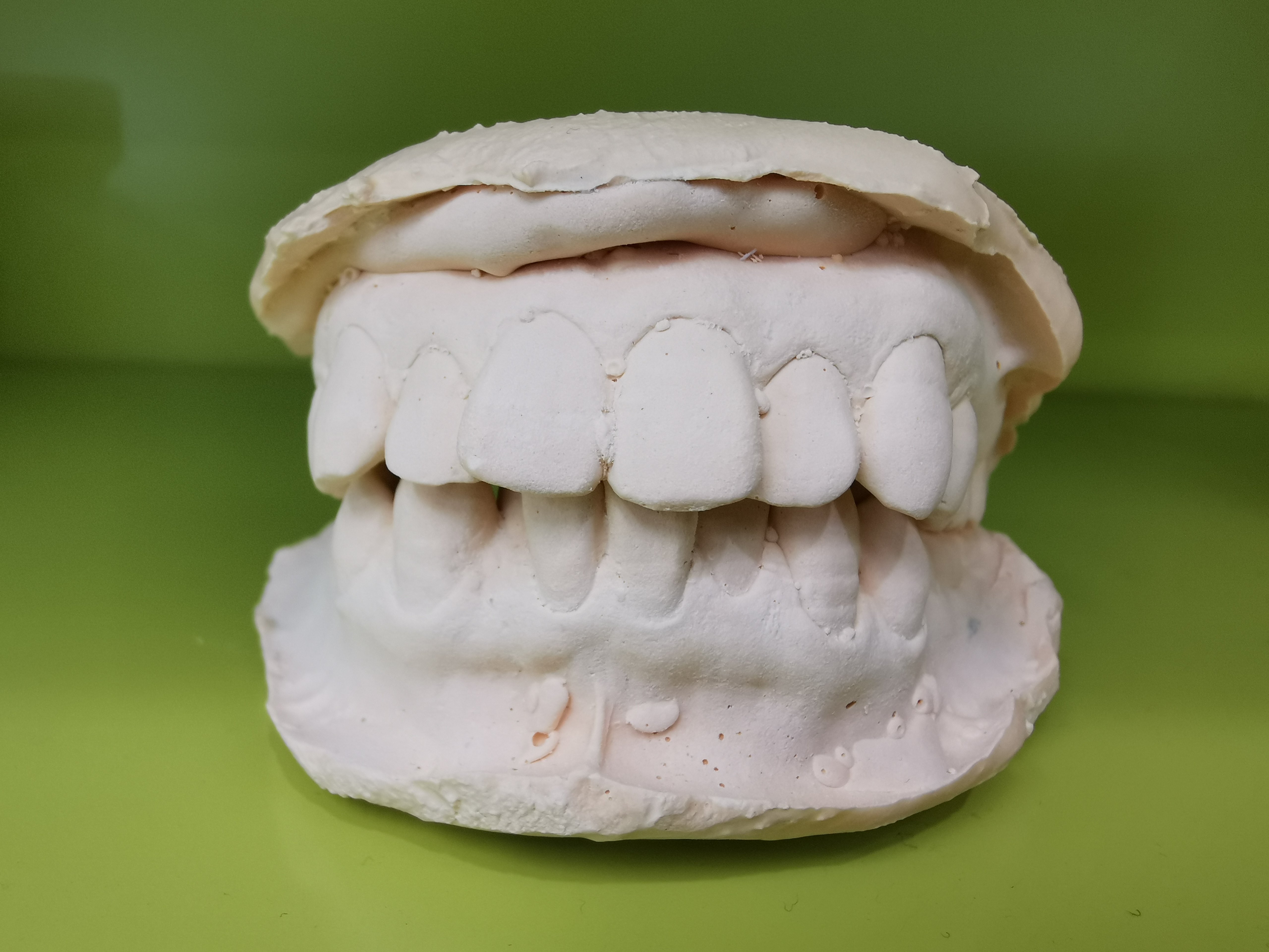 自然咬合牙齿模型图图片