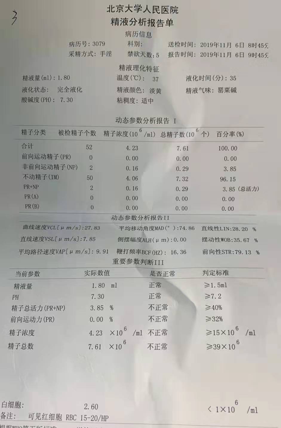 梗阻性少精子症