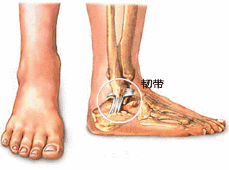 为什么有些人会频频崴脚