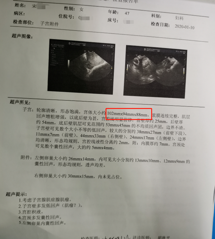 案例详解:曼月乐,达菲林对于腺肌症的现实意义_子宫腺肌症 - 好大夫