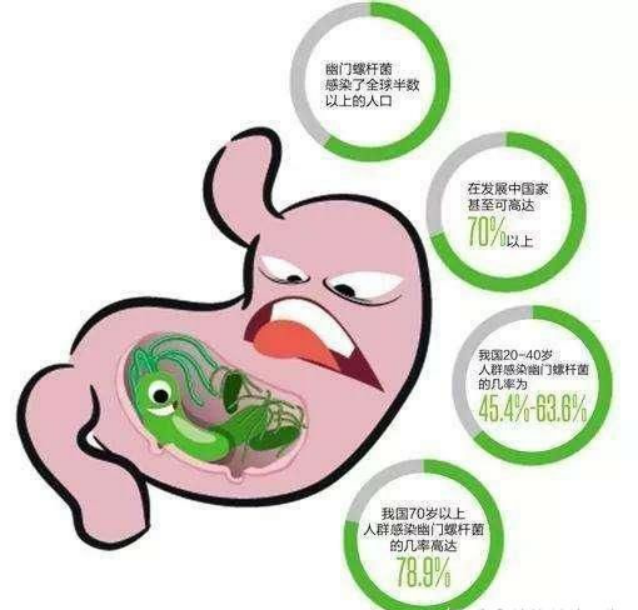 亦即幽門螺桿菌胃炎,染者中約15% ～ 20%發生消化性潰瘍,5% ～ 10%