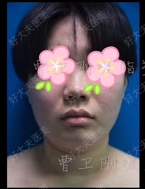 圖文圖片