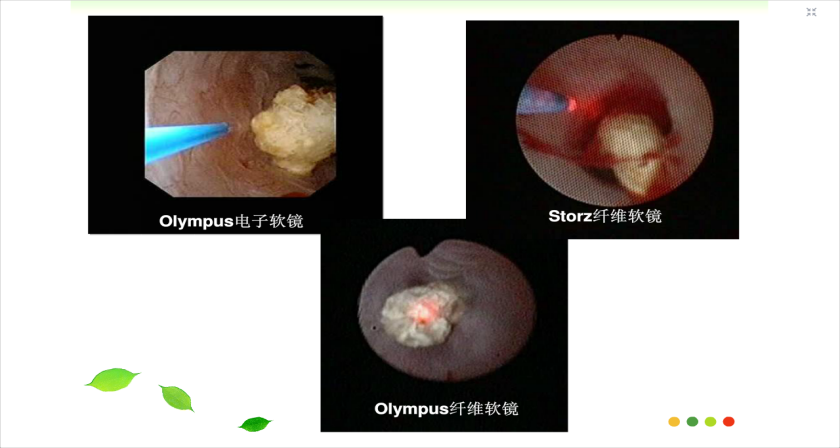 高清输尿管软镜,先进仪器为我科优质医疗服务提供保障. - 好大夫在线