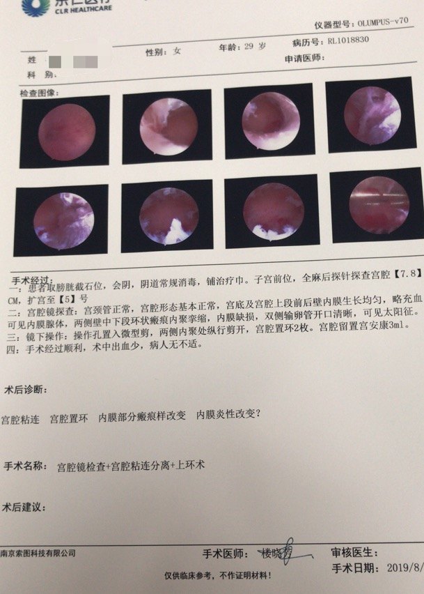 宮腔鏡在生殖方面的優勢三