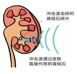暂无