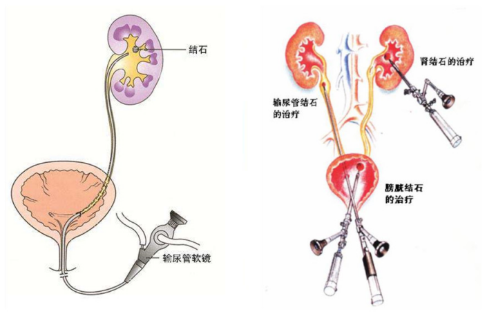 暂无
