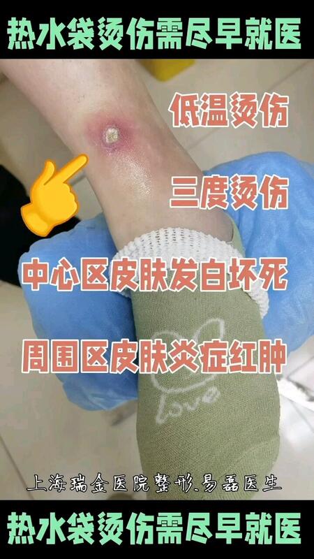 視頻封面