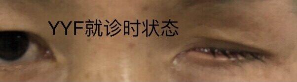 圖文圖片