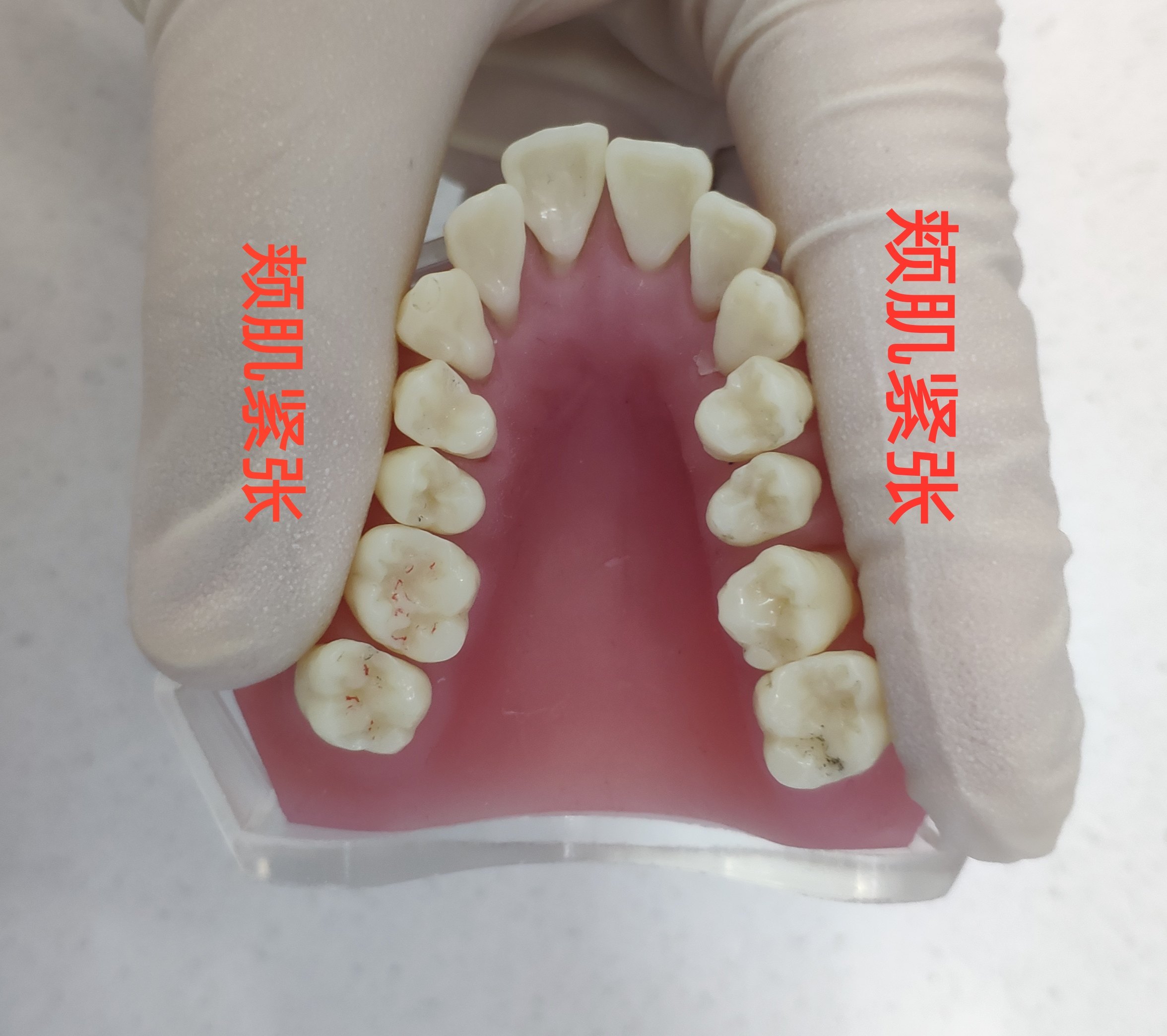 牙弓形态分几种图片图片