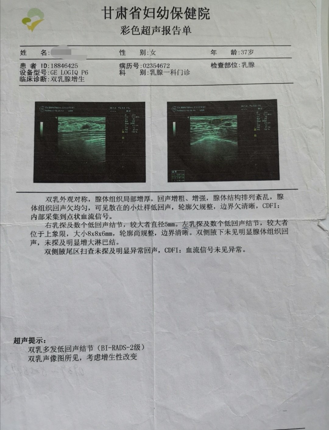 乳腺彩超检查_超声诊断_检查_介绍 - 好大夫在线