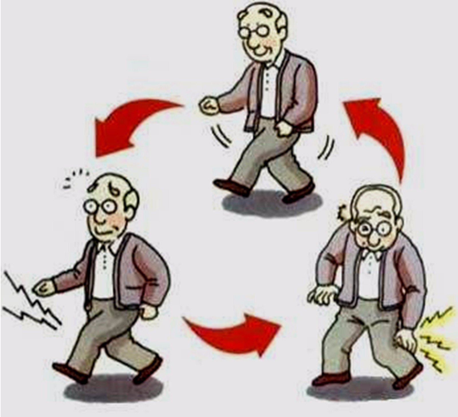 和疼痛,在运动过程中尤为明显,常表现为小腿部肌肉酸痛,即间歇性跛行