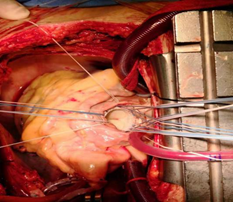 1574391813649251.png image.png