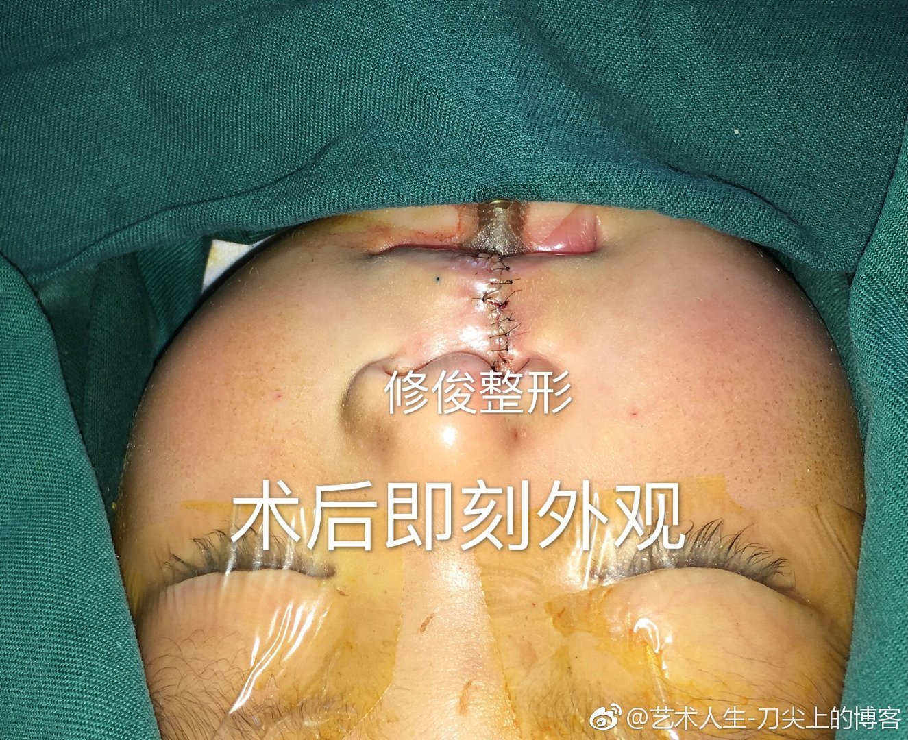 暂无