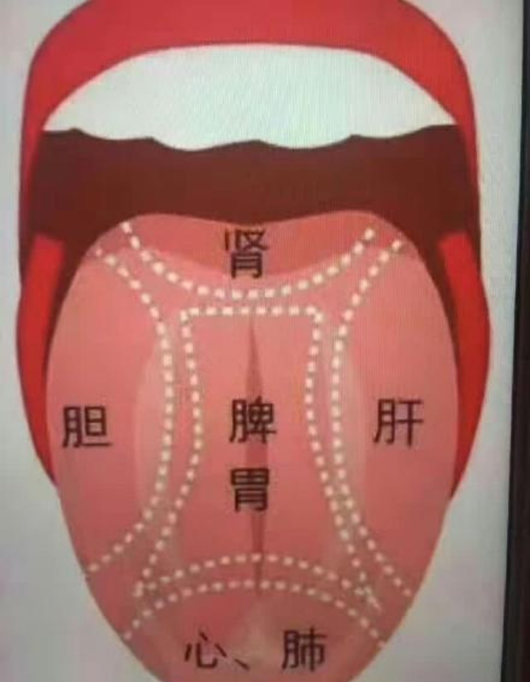 地图舌图片-千图网
