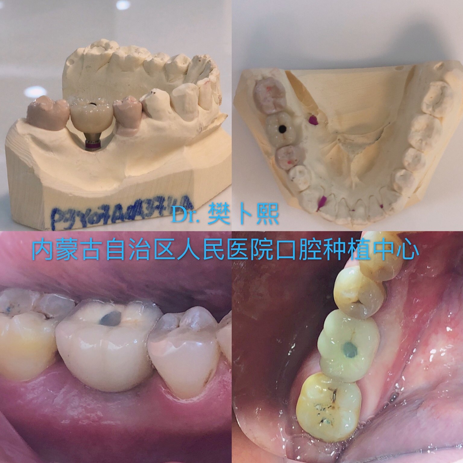 暂无
