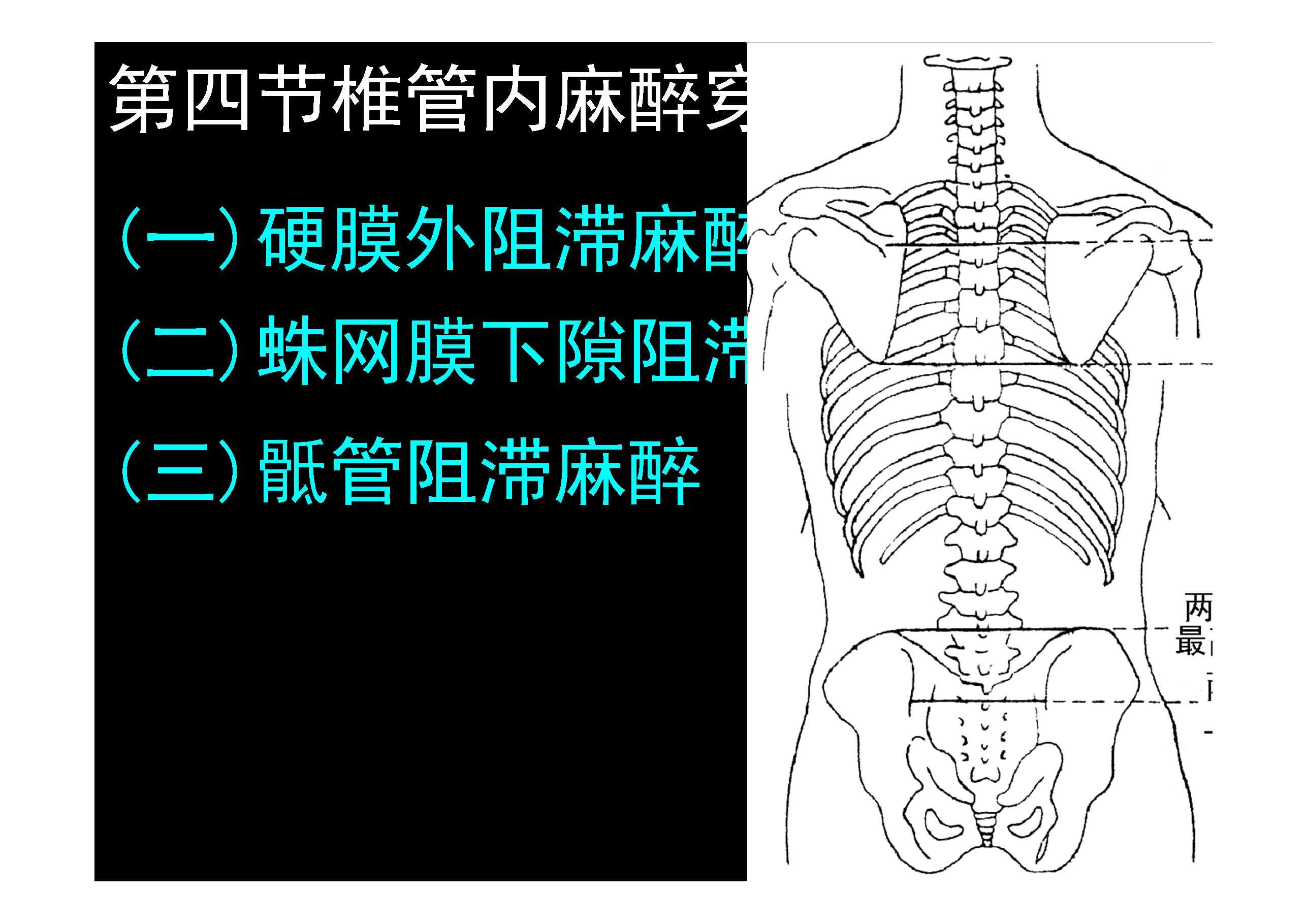 脊椎源性疼痛解剖椎管被膜間隙