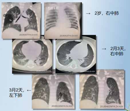 1576419234526843.png image.png