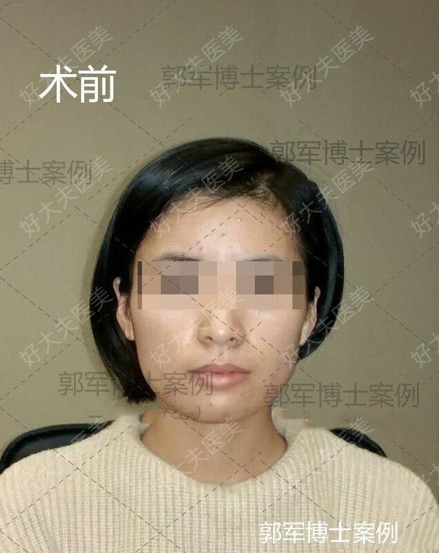 圖文圖片
