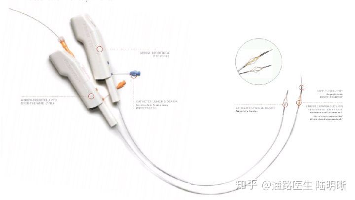使用内镜活检钳等夹取血栓抽吸取栓:使用血栓抽吸导管,鞘管等将血栓