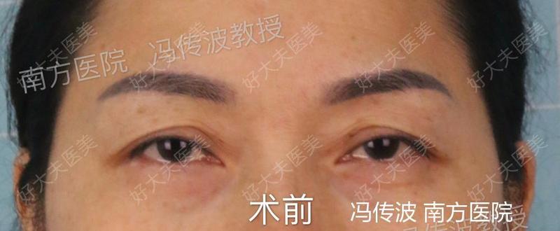 圖文圖片