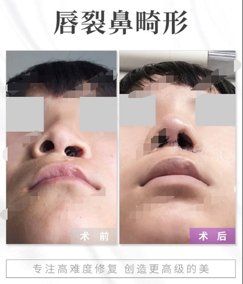1597379341557851.png image.png